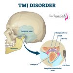 Cirugía Ortognática y Articulación Temporomandibular